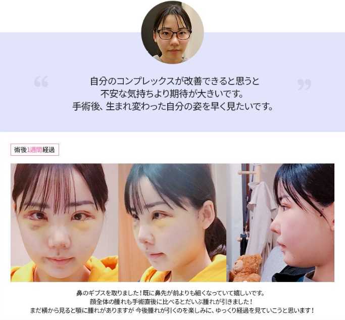 深田えいみの整形の内容とその結果