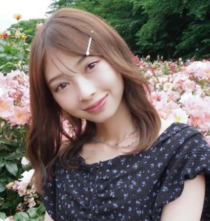 辻野かなみ整形の噂に専門家が見解!目元の変化は本物?学生時代は?